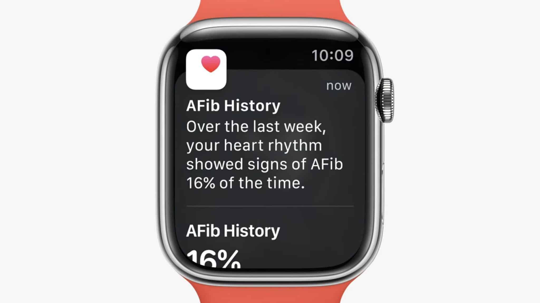 ประวัติ AFib Apple Watch