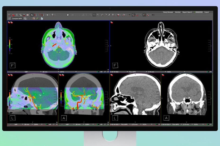 Studio Display XDR การแพทย์